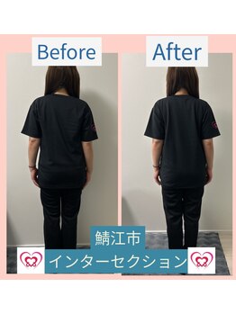 腰の整体インターセクション/美容整体【歪み改善】