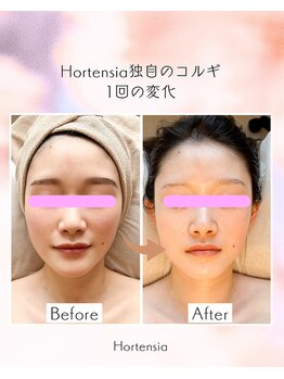 オルテンシア(Hortensia)/コルギ☆ビフォーアフター