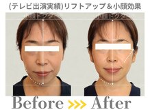 小顔ドクター