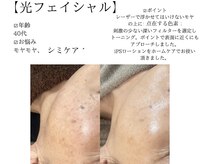 サロンツキ(salon tuki)/光フェイシャル症例/徳島