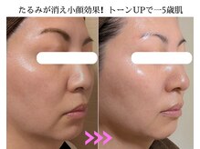 キラリ リラクゼーション(Kirary relaxation)/1回で目に見える効果！