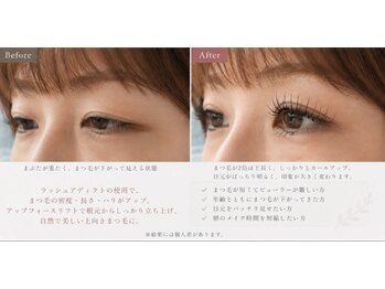 アビアンドアッシュ アイラッシュ(Abi&Ass eyelash)/アップフォースリフト+美容液