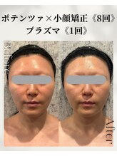 ネイルアンドアンチエイジングドゥシール(Docile)/40代女性｜フェイスライン改善
