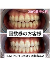 プラチナムビューティ 四条烏丸店(PLATINUM Beauty)/回数券ご利用のお客様