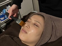 オアシス 相模大野店(Oasis)/【酸ピーリング】毛穴ケアに◎