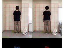 けいのき鍼灸整骨院/姿勢から身体を楽に!整体/肩こり