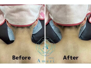 サロンアメリ 高松丸亀町店(Salon Ameri)/香川 高松 うなじ脱毛 アメリ