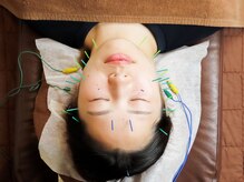 健康堂 荏原町院/美容鍼もお任せください♪