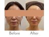 【短期間で見た目を変えたいあなたへ】フェイシャルコース3回券
