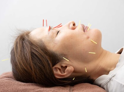 たかさきひかり鍼灸整骨院の写真