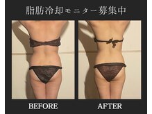 ブルースター(Blue Star)