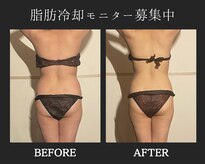 ブルースター(Blue Star)