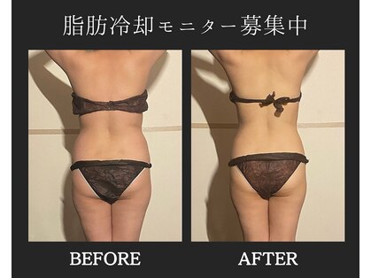 ブルースター(Blue Star)の写真