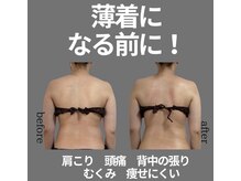 オルオル(.olu olu)の雰囲気（小顔調整）