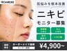【モニター募集】繰り返すニキビでお悩みの方　￥13,200→￥4,900