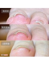 マニクション ネイルズ(M2CT NAILS)/