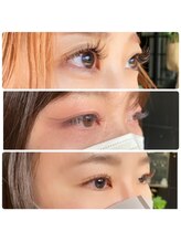 エマ 桃山台(emma)/snap