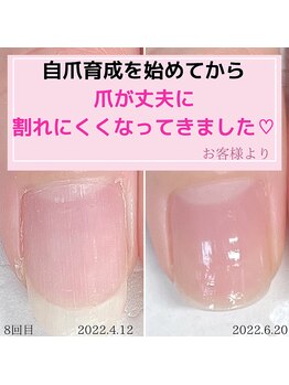 ミミ(mimi)/爪が丈夫になりました！