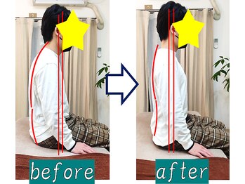 奏流(soryu)/ダル重い肩首まわりが改善!