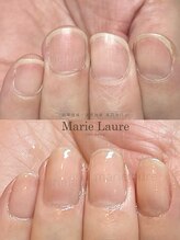 マリーロール 淀屋橋本店(Marie Laure)/自爪育成/深爪矯正/ネイルケア