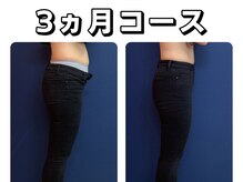 久留米スポーツ整骨院 整体院/エステ◆痩身インディバエステ