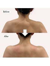 じぶんdeエステ 池袋店/骨格矯正術で肩スッキリ！