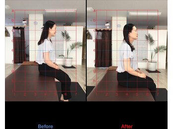 ストレチックス 近江八幡店/BeforeAfter