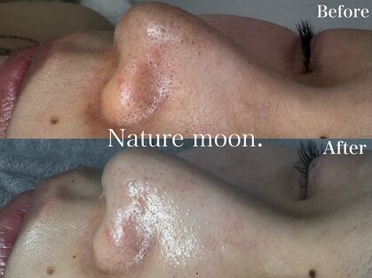 ナチュールムーン(Nature moon.)の写真