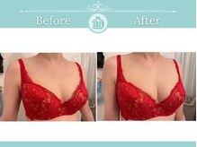 美人バスト 新潟店/ 【バストアップ★育乳】症例