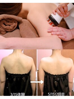 エステティックサロン アールグレーの写真/ハイパーナイフ/キャビテーション/sogire etc，幅広いメニュー＆マシンご用意◎