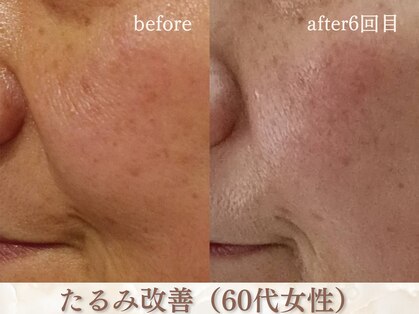 スリーエッセンス(3THREE ESSENCE)の写真