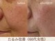 スリーエッセンス(3THREE ESSENCE)の写真