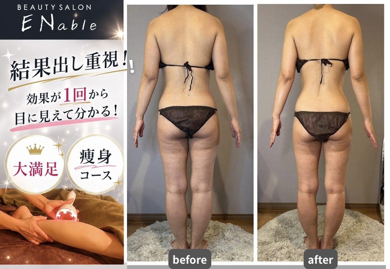 新木屋瀬駅で毛穴ケアが人気のエステサロン｜ホットペッパービューティー