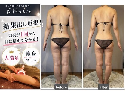 エネイブル(ENable)の写真