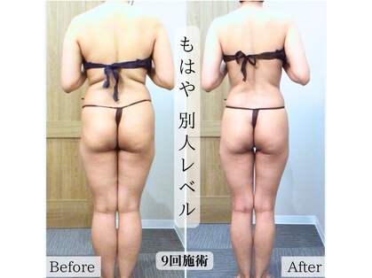 レイプラス イオン卸町店(RAY PLUS)の写真