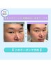 《再来/学割U24/人気No.2》美眉WAX+毛量調整(間引き/カット)×鼻毛WAX #眉毛