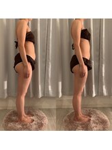 リブリス ボディデザインサロン(rebliss)/リンパケアで腸内すっきり！20代