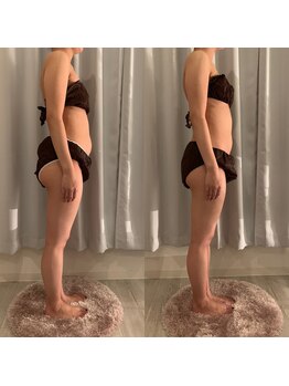 リブリス ボディデザインサロン(rebliss)/リンパケアで腸内すっきり!20代