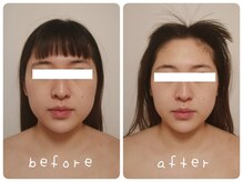 ホワイトサロンファミリア(whitesalon familia)/小顔コルギ＋毛穴洗浄＋美容液