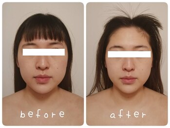 ホワイトサロンファミリア(whitesalon familia)/小顔コルギ+毛穴洗浄+美容液