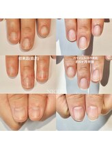 ニコプラス(NICO+)/自爪育成中