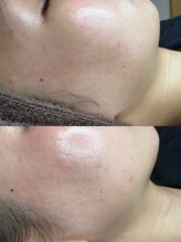 ネイル&アイラッシュ ルミア(Nail & Eyelash LUMIA)/もみあげwax