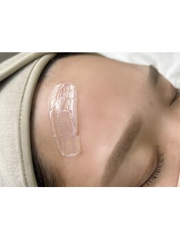 顔脱毛がしたい