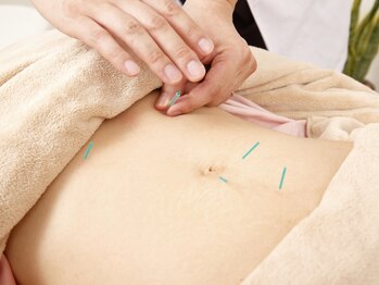 ウィズ(Wiz)の写真/妊活鍼＆腸活メソッドで体内から元気にして健康的な体づくりをサポート