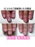 【自爪育成口コミのご投稿を頂いた女性限定】¥24,200→¥23100