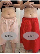 マホロバ セカンド(mahoroba 2nd)/くびれスッキリ腸マッサージ