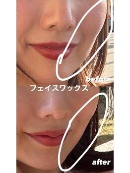 ラダ(RADA)/フェイスワックス/顔脱毛