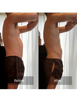 アリッチ 岡崎店(a.Rich)/脂肪燃焼90分1回横厚みスッキリ