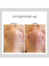 ポムハヌル(pom.haneul)/韓国肌管理室