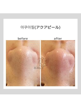 ポムハヌル(pom.haneul)/韓国肌管理室